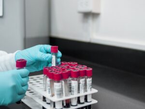 Lab testing blood samples in a tray.